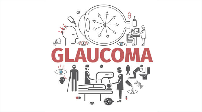 glaucoma surgery in hyderabad